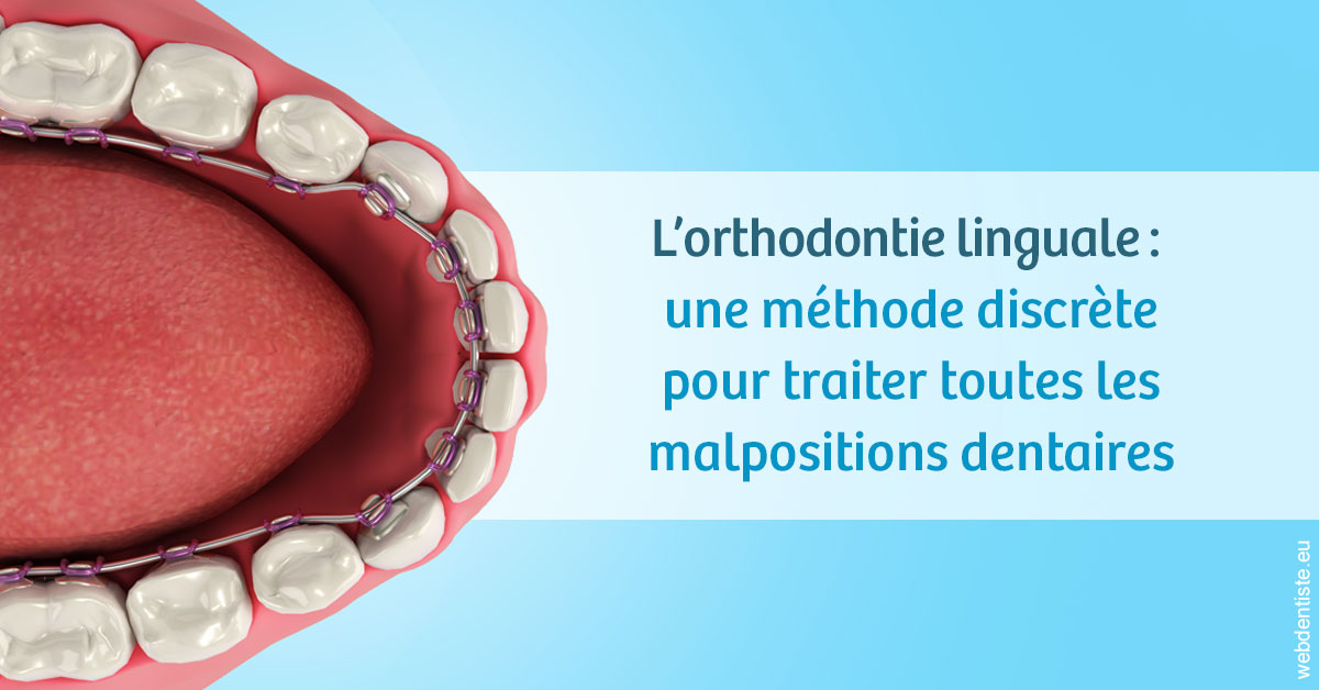 https://selarl-drs-choquin.chirurgiens-dentistes.fr/L'orthodontie linguale 1