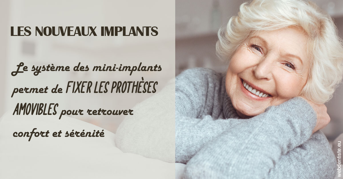 https://selarl-drs-choquin.chirurgiens-dentistes.fr/Les nouveaux implants 1