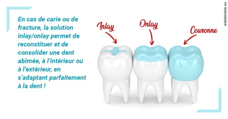 https://selarl-drs-choquin.chirurgiens-dentistes.fr/L'INLAY ou l'ONLAY