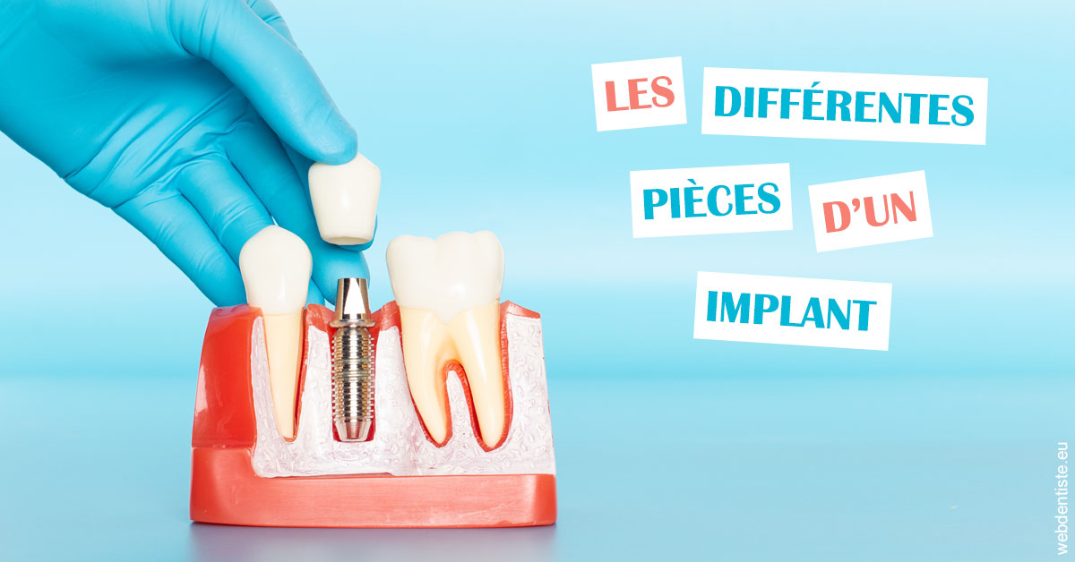 https://selarl-drs-choquin.chirurgiens-dentistes.fr/Les différentes pièces d’un implant 2