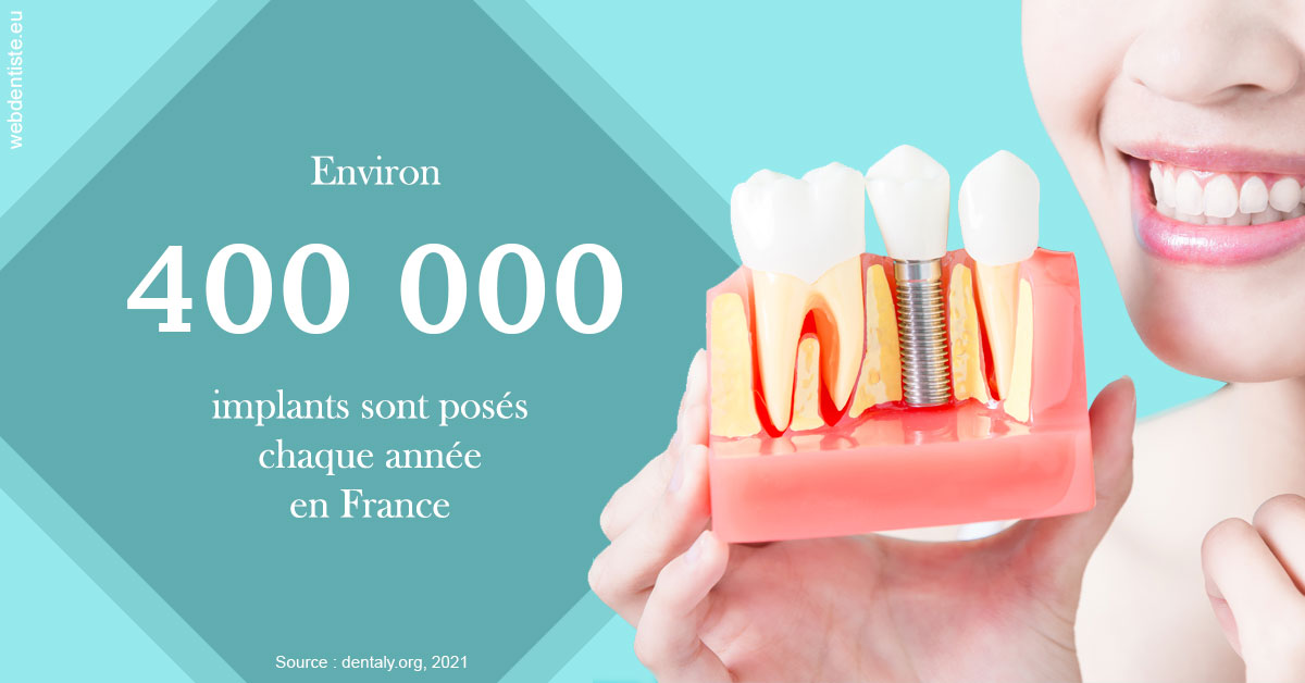 https://selarl-drs-choquin.chirurgiens-dentistes.fr/Pose d'implants en France 2