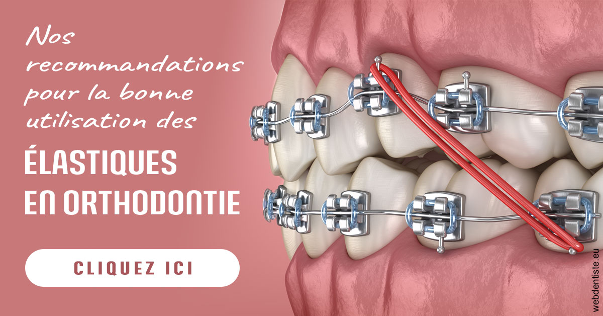 https://selarl-drs-choquin.chirurgiens-dentistes.fr/Elastiques orthodontie 2